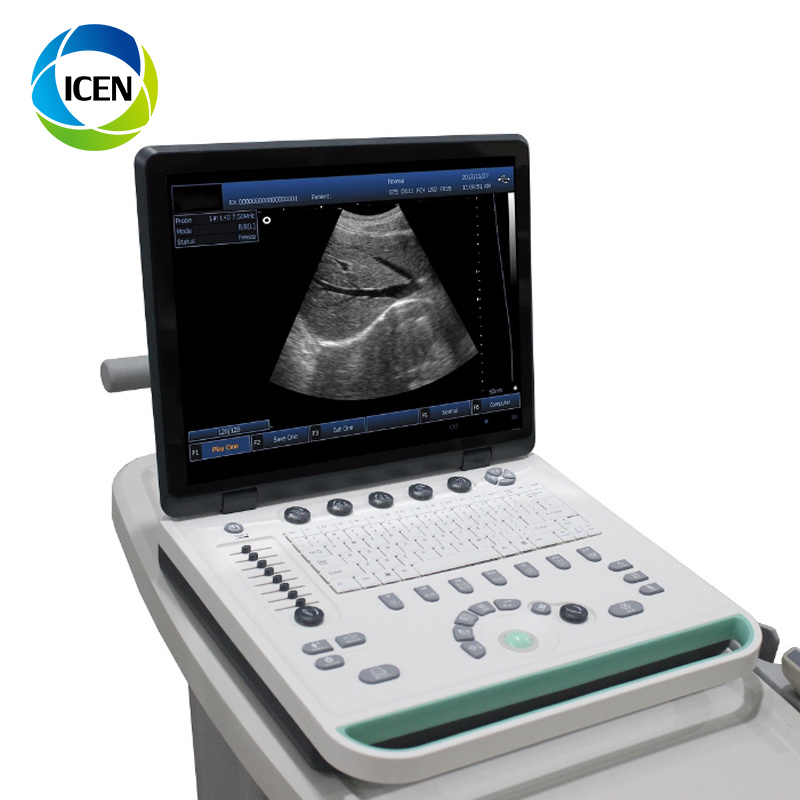 in-A032-1 Portable Digital Ultrasound Pregnancy Equipment Price