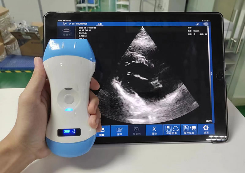 in-A3c Portable Ecografo Ios Scanner Ultrasound USG Transvaginal Wireless Probe Price-14