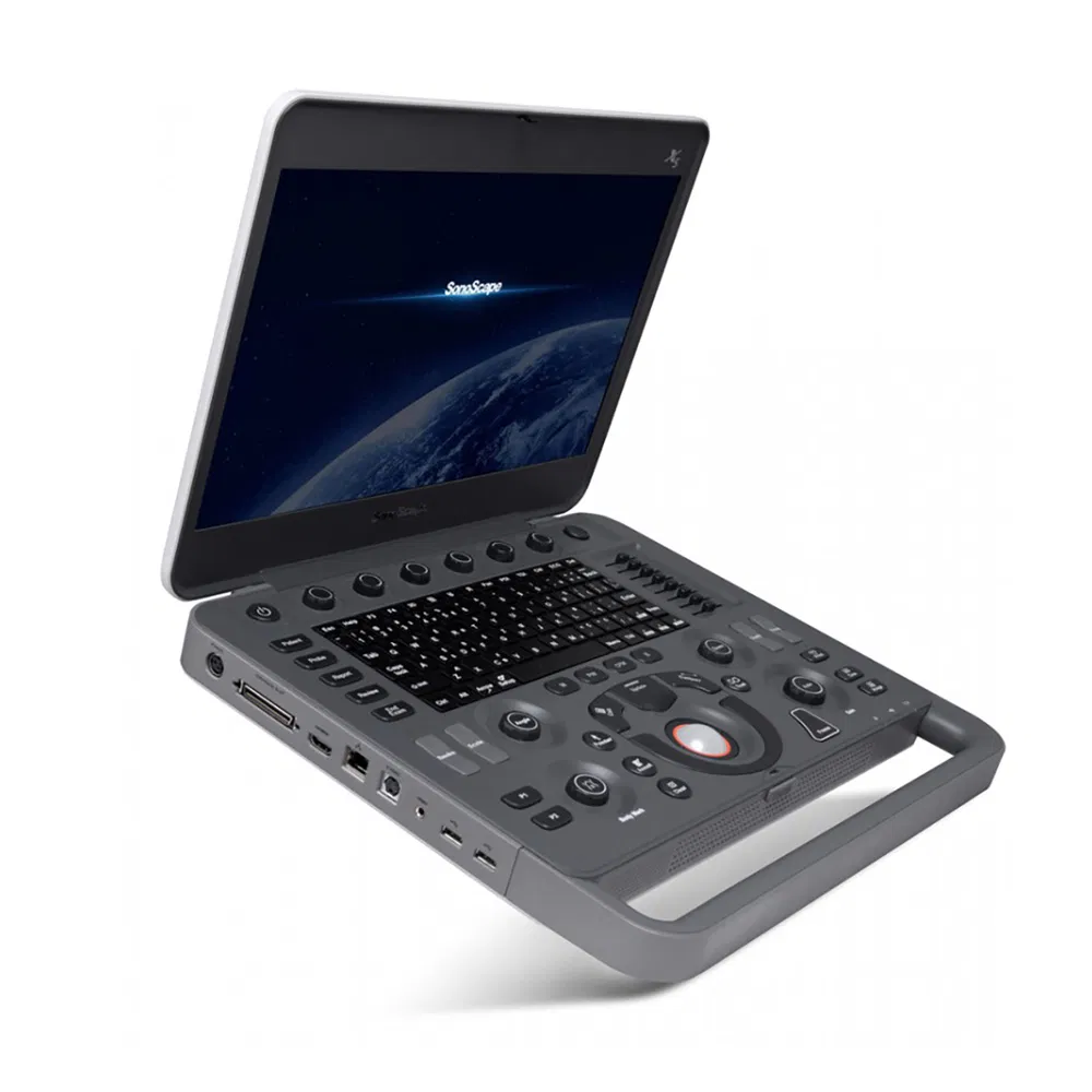 in-AC80 Ob Gyn Pregnant Echography Digital Ultrasound Machine 3D/4D Color Doppler Trolley Ultrasound Scanner-2