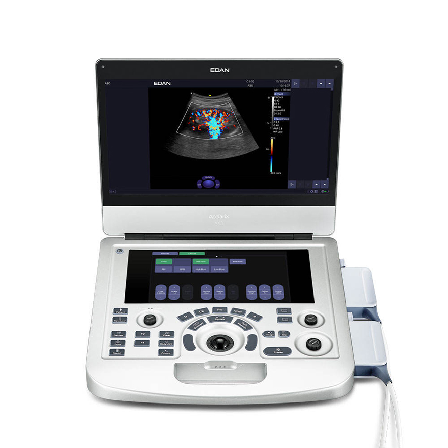 in-AC80 Ob Gyn Pregnant Echography Digital Ultrasound Machine 3D/4D Color Doppler Trolley Ultrasound Scanner-6