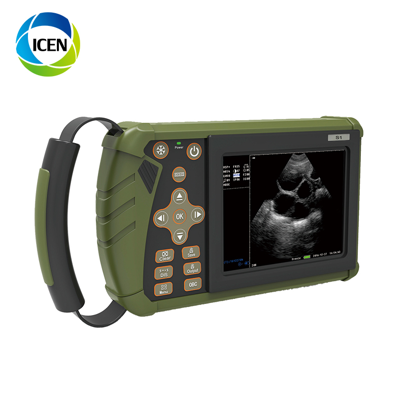 in-AC80 Ob Gyn Pregnant Echography Digital Ultrasound Machine 3D/4D Color Doppler Trolley Ultrasound Scanner-7