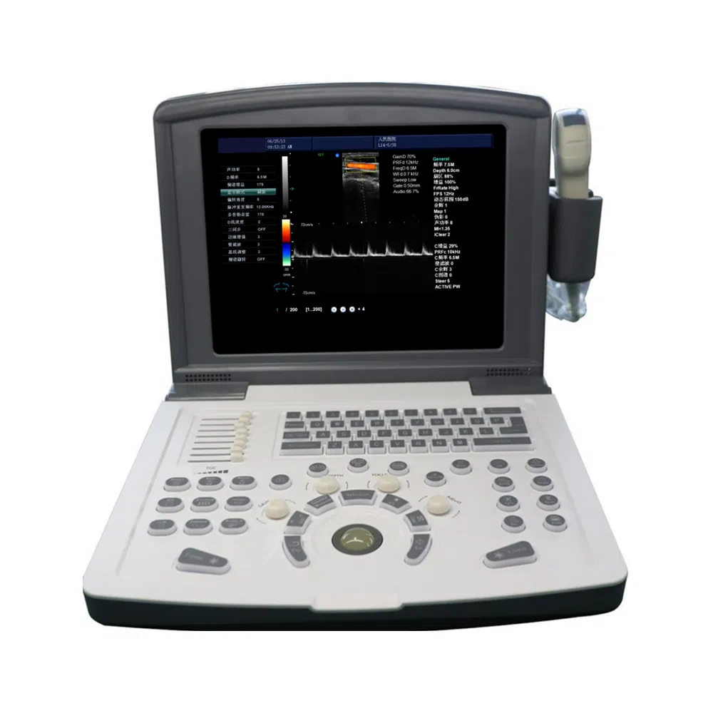 in-AC80 Ob Gyn Pregnant Echography Digital Ultrasound Machine 3D/4D Color Doppler Trolley Ultrasound Scanner-12