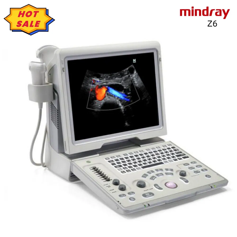 in-AC80 Ob Gyn Pregnant Echography Digital Ultrasound Machine 3D/4D Color Doppler Trolley Ultrasound Scanner-15