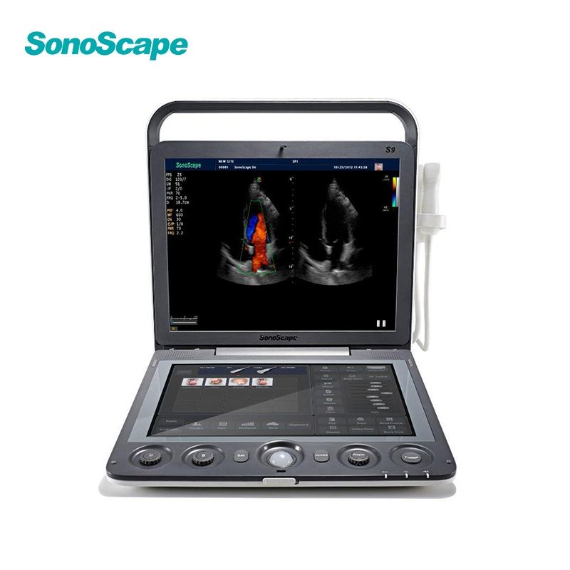 in-AC80 Ob Gyn Pregnant Echography Digital Ultrasound Machine 3D/4D Color Doppler Trolley Ultrasound Scanner-19