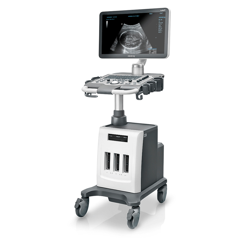 in-AC80 Ob Gyn Pregnant Echography Digital Ultrasound Machine 3D/4D Color Doppler Trolley Ultrasound Scanner-20