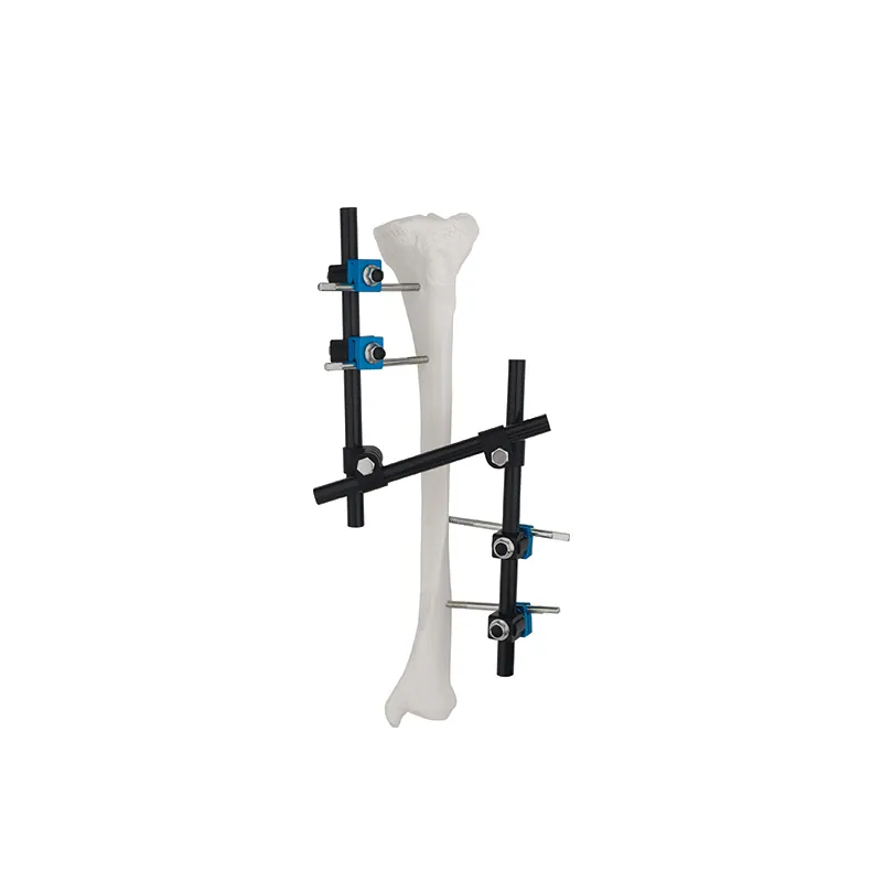 Z Type(Enhancement Mode) External Fixator